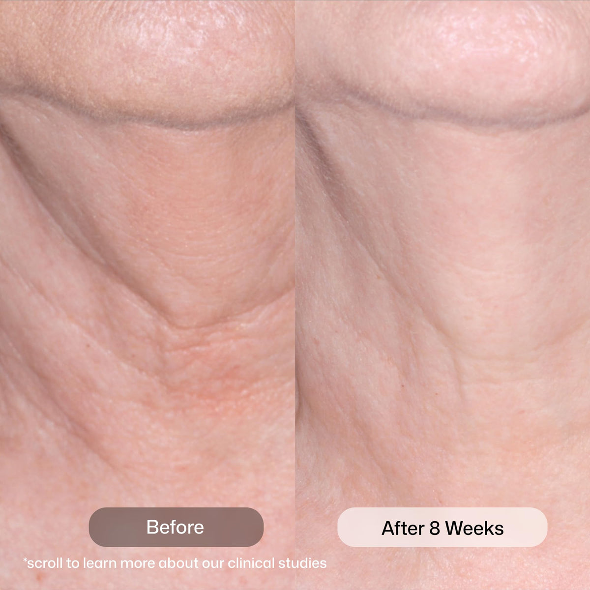 Revision Skincare open jar cream texture demonstrating smooth hydration