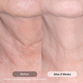 Revision Skincare open jar cream texture demonstrating smooth hydration