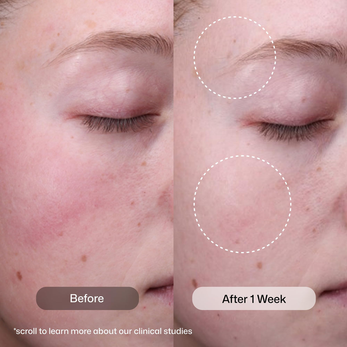 Revision Skincare closeup of serum texture highlighting lightweight, absorbent finish