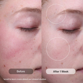 Revision Skincare closeup of serum texture highlighting lightweight, absorbent finish