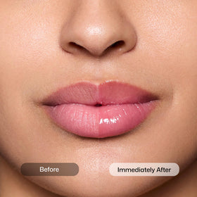 Revision Skincare close-up of hyaluronic beads indicating moisture and plumping support