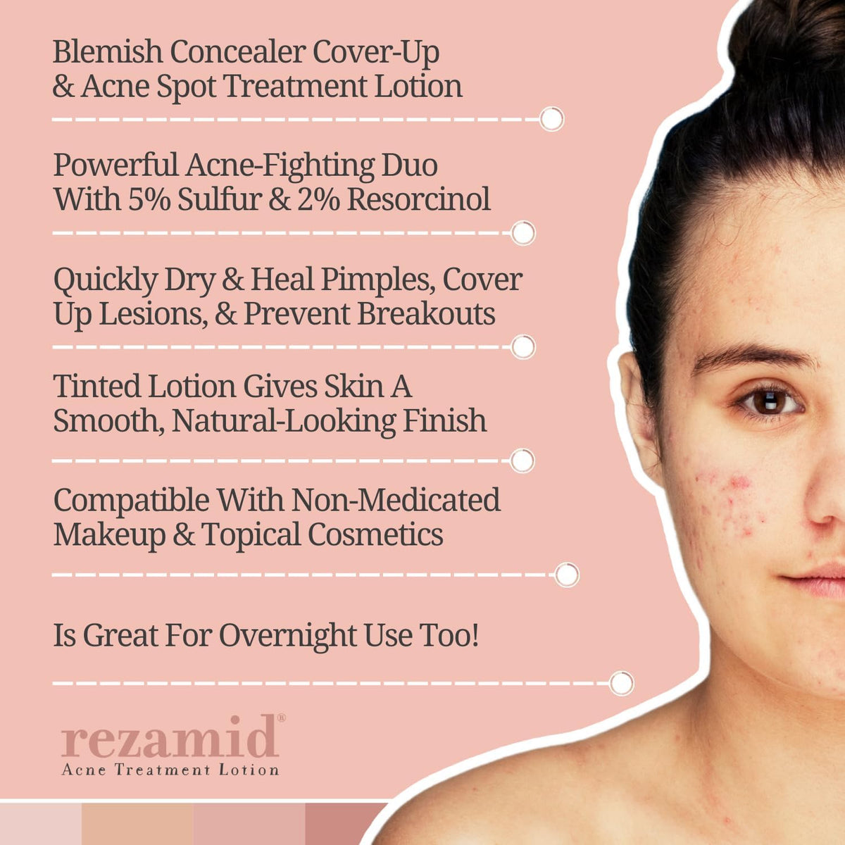 Rezamid application on skin illustrating spot coverage and blending