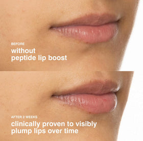 Rhode lip boost lifestyle bag shot illustrating portable hydration on the go