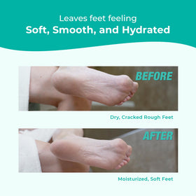Richenna foot file and cream kit showing spa-like tools