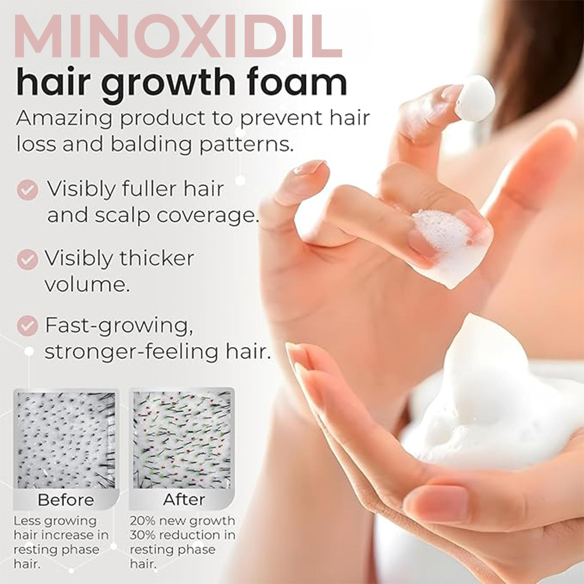 Rida Hair Research Institute foam applied to scalp showing targeted coverage benefit
