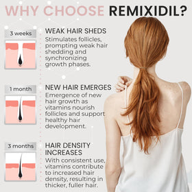 Rida Hair Research Institute before and after composite showing fuller hair