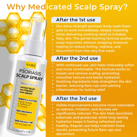 Rida Hair Research Institute application on scalp demonstrating targeted soothing