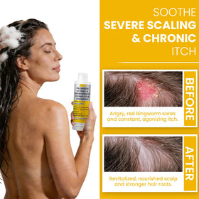 Rida Hair Research Institute lather on scalp demonstrating soothing action and reduced flakes
