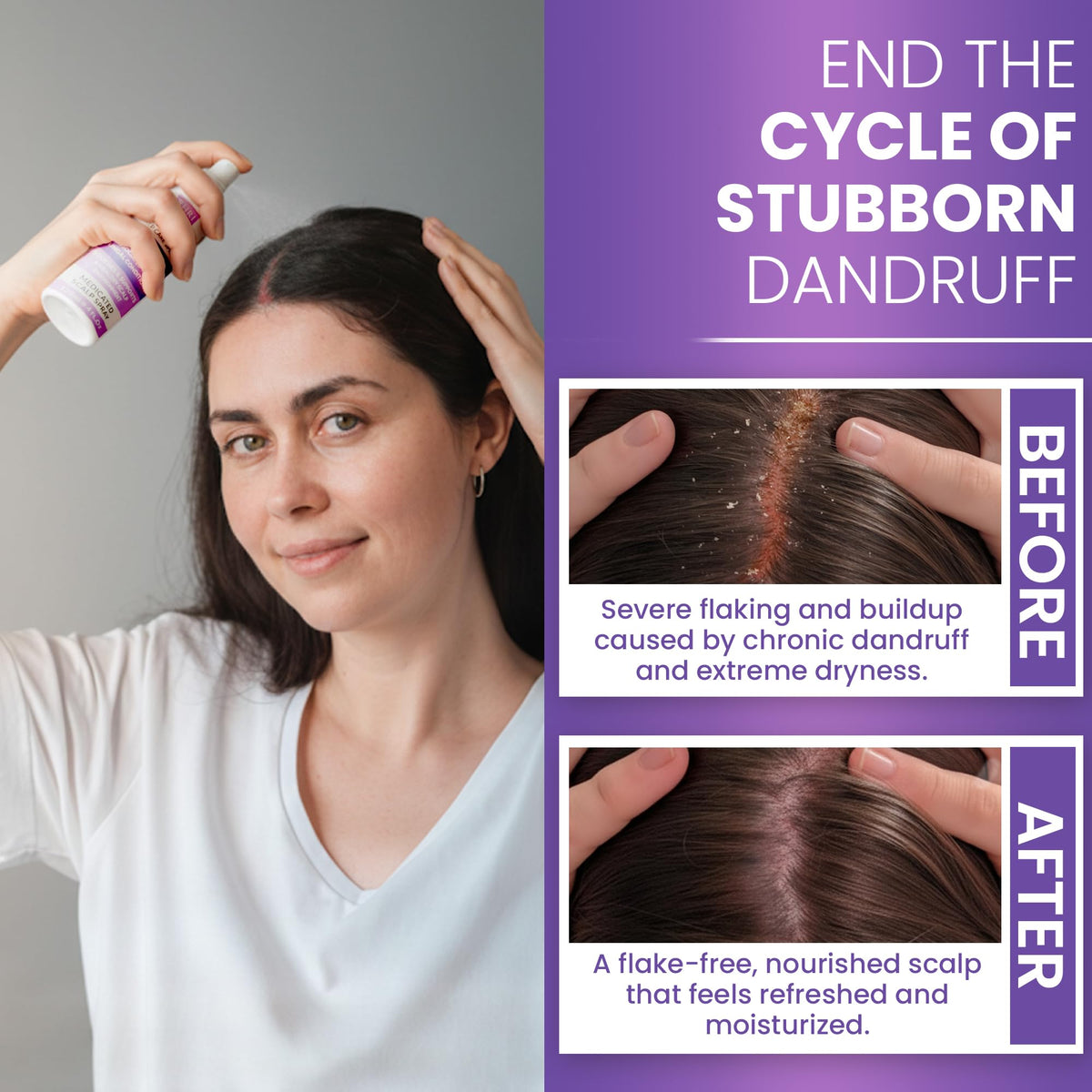 Rida Neoketramin scalp application in use, demonstrates targeted relief and comfort