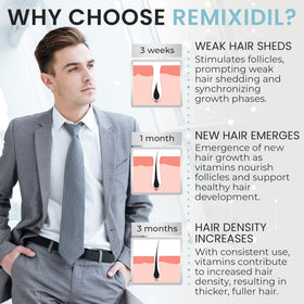 Rida Hair Research Institute beard before-and-after visual showing fuller appearance