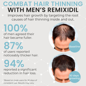 Rida Hair Research Institute capsule texture detail suggesting easy swallowing benefit
