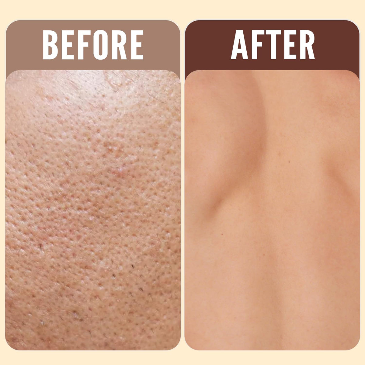 Rinse & Robust close-up of bar texture highlighting moisturizing benefit