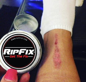 RipFix being applied to a hand demonstrating soothing protection during recovery