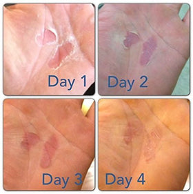 Climber using RipFix between routes highlighting better grip and skin care