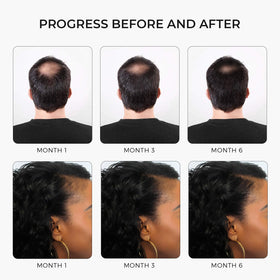 Rivermint key ingredients arrangement with biotin and castor oil for nourishing support