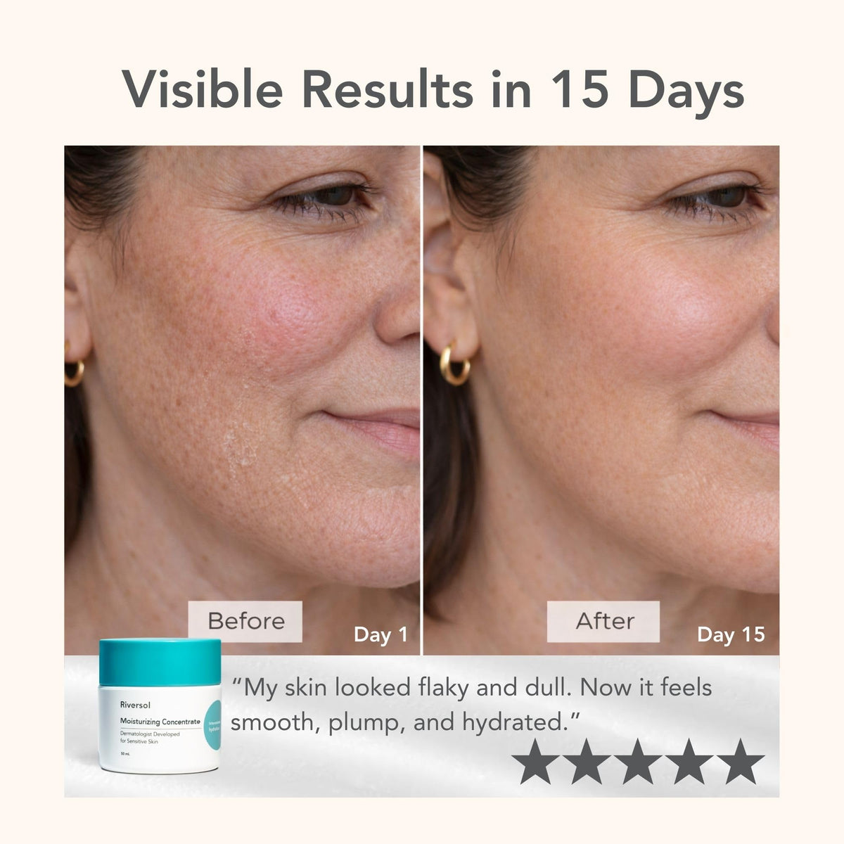 Riversol cream on hand demonstrating spreadability and immediate softness