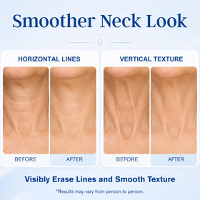 RMCYDS before and after skin composite showing firmer-looking texture
