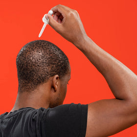 Man applying Ro minoxidil to thinning crown showing simple routine