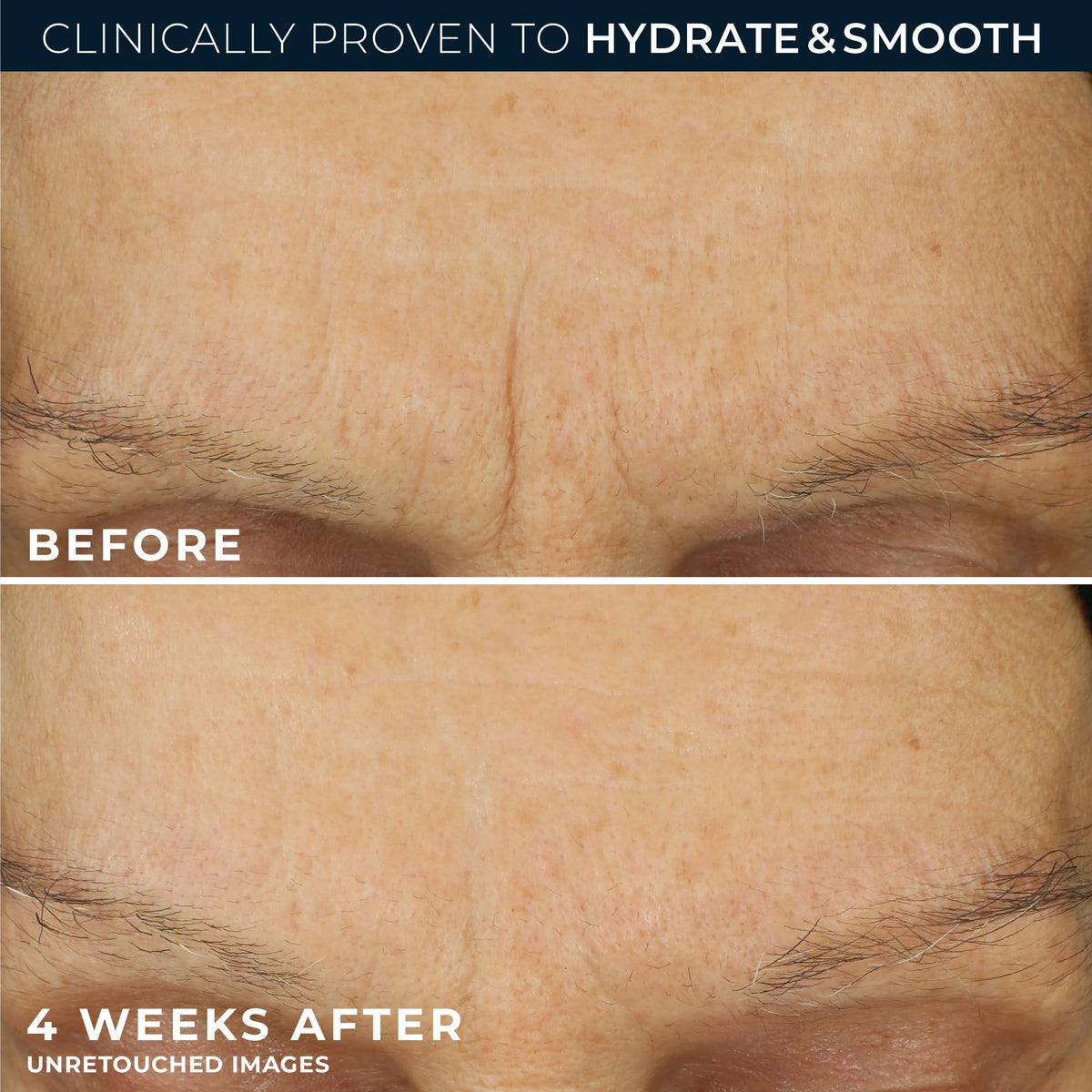RoC moisturizer being absorbed on skin demonstrating non-greasy finish