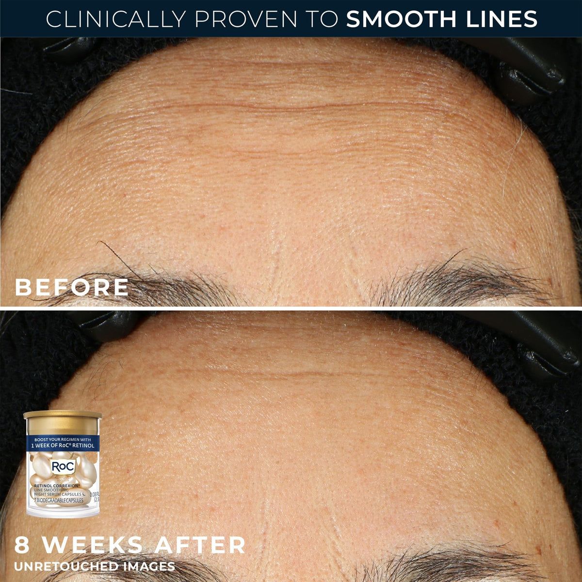 Person applying RoC products at night demonstrating routine for smoother-looking skin