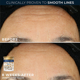Person applying RoC products at night demonstrating routine for smoother-looking skin