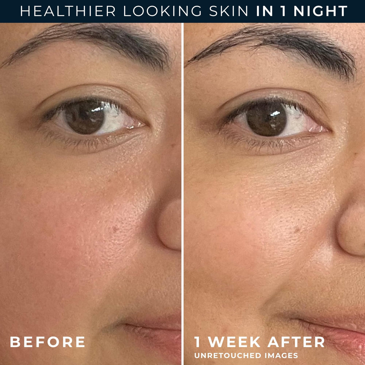 RoC retinol eye cream packette included to target delicate eye area