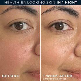 RoC retinol eye cream packette included to target delicate eye area