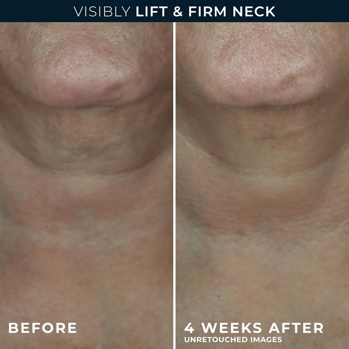RoC cream applied upward on neck demonstrating firming and contouring