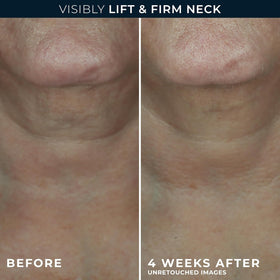 RoC cream applied upward on neck demonstrating firming and contouring
