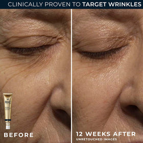RoC eye cream dabbed under eye demonstrating reduced puffiness benefit