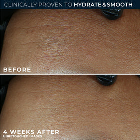 RoC hyaluronic droplets macro illustrating deep hydration boost