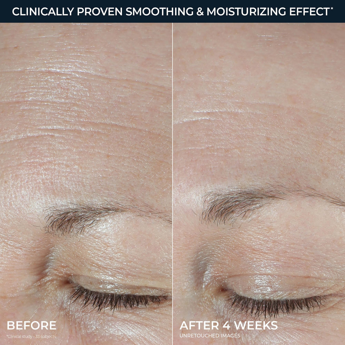 RoC product dispensed on finger ready to apply for plumping effect