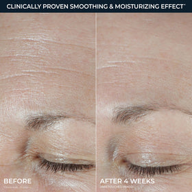RoC product dispensed on finger ready to apply for plumping effect