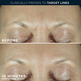 RoC triple hyaluronic acid graphic highlighting multi-level hydration
