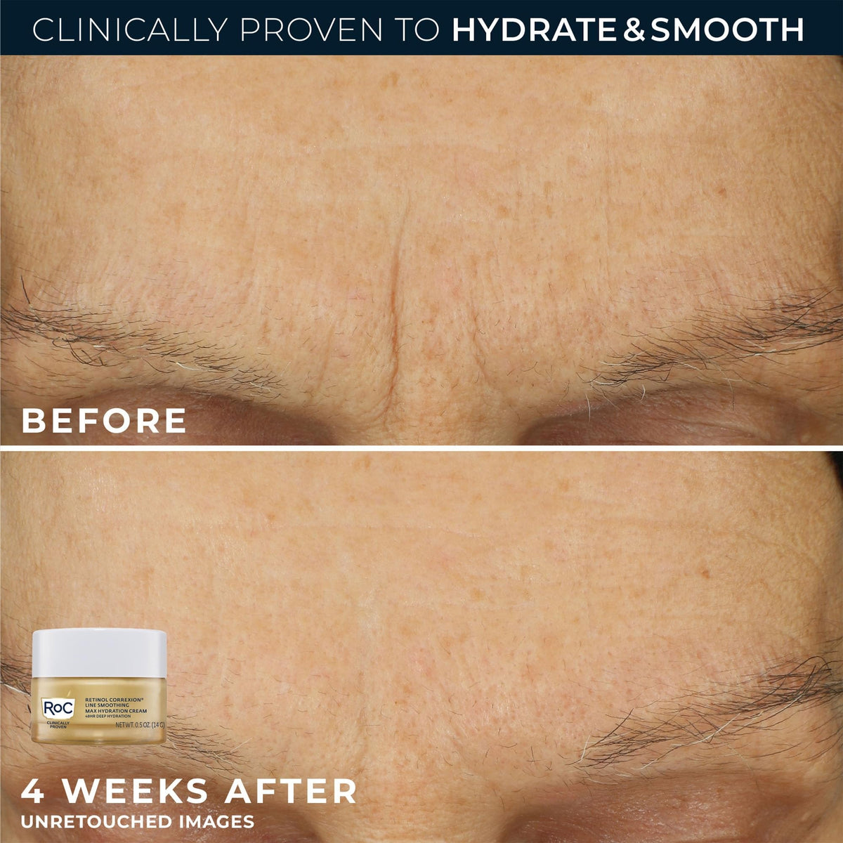 RoC product label close-up showing ingredients and clinical retinol information