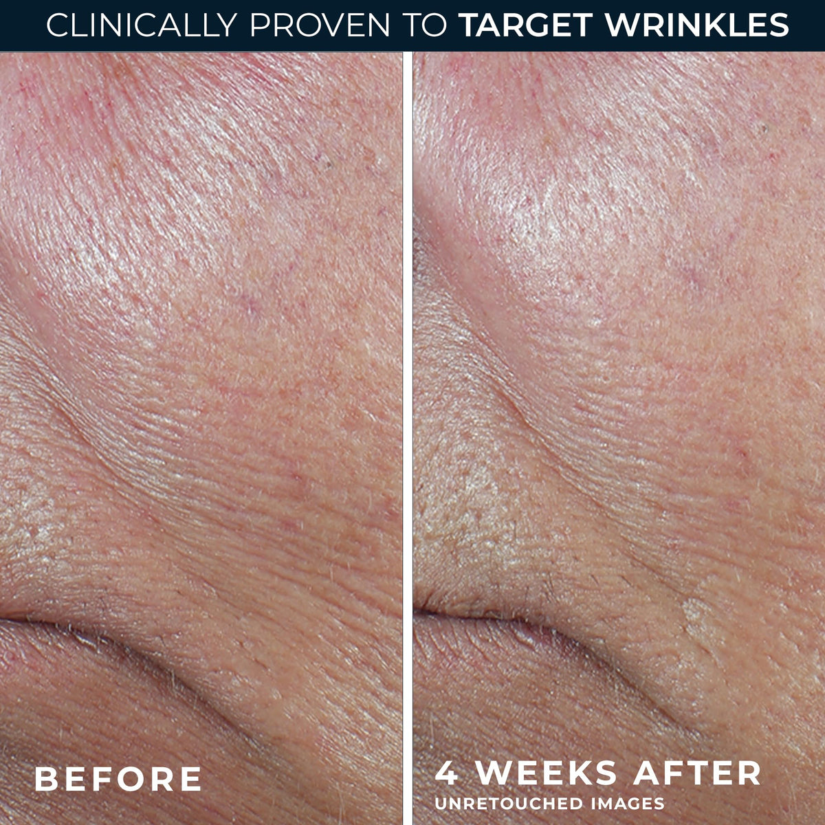RoC product label and directions emphasizing dermatologist collaboration