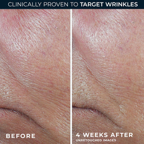RoC product label and directions emphasizing dermatologist collaboration