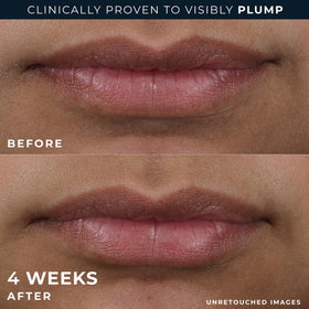 RoC before and after lips demonstrating visible plumping effect
