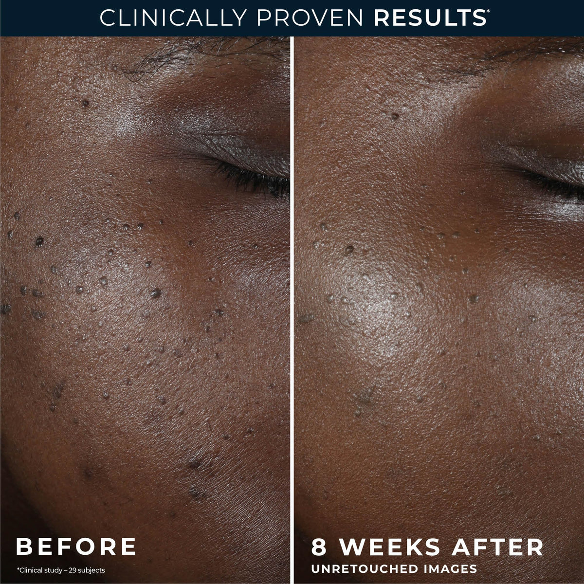 RoC packaging comparison new look same formula clarifies update benefit