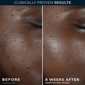 RoC packaging comparison new look same formula clarifies update benefit
