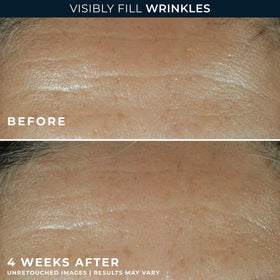 RoC bottle label detail showing ingredients and clinical retinol credentials for trust