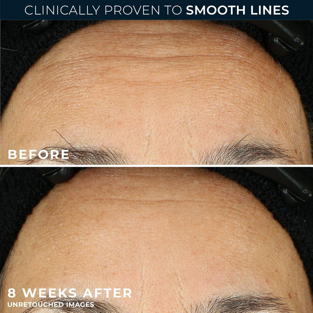 RoC capsule opened and serum applied on hand showing mess-free use