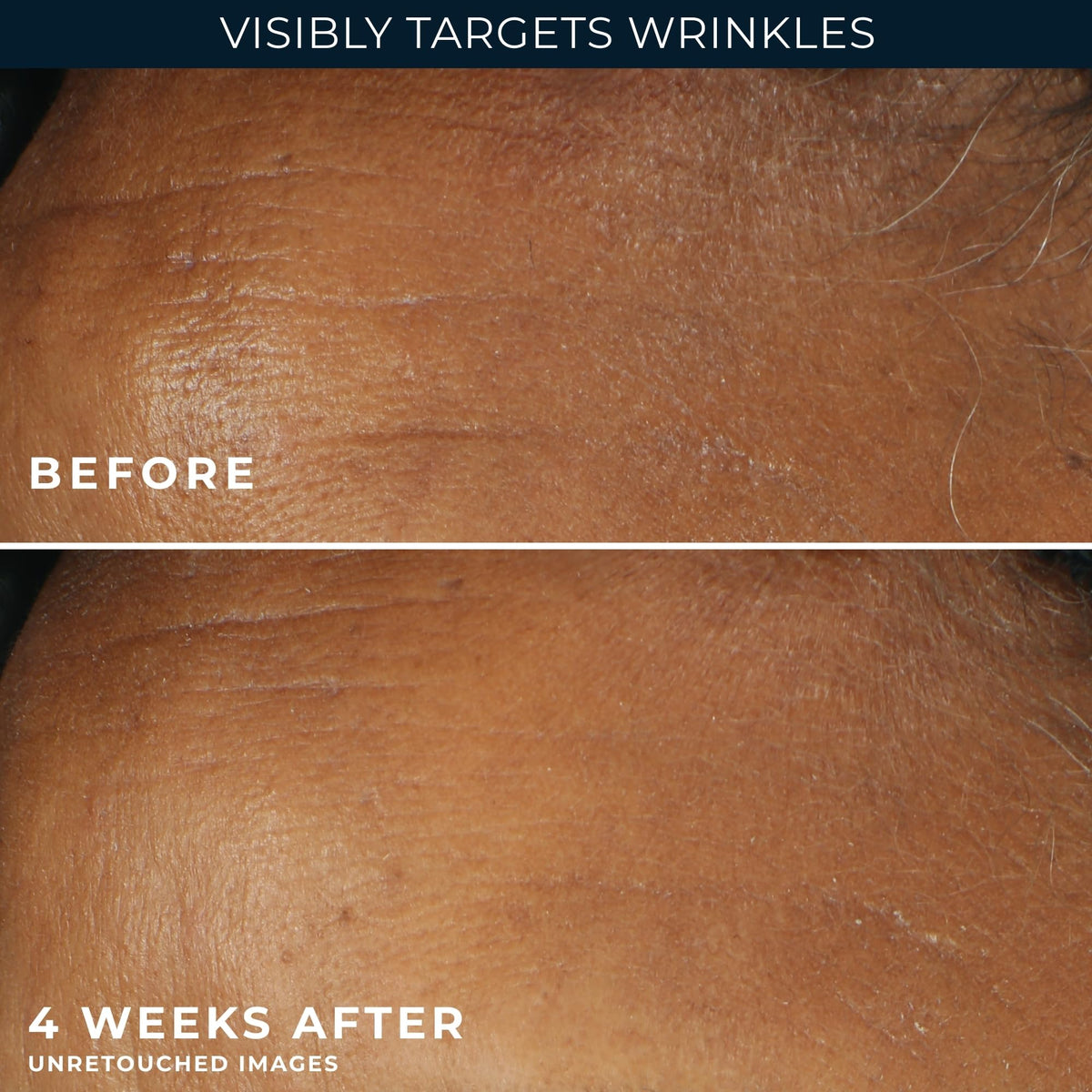 RoC moisturizer swirled on skin showing fast absorption and hydration
