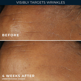 RoC moisturizer swirled on skin showing fast absorption and hydration