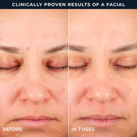 RoC Step 2 pad saturated with solution highlighting retinol renewal support