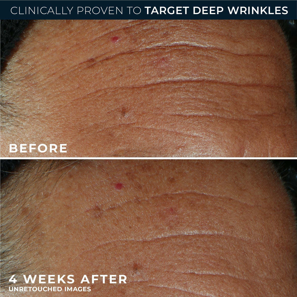 RoC retinol packette next to box showing convenient single-dose option