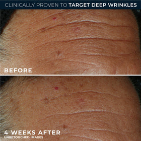 RoC retinol packette next to box showing convenient single-dose option