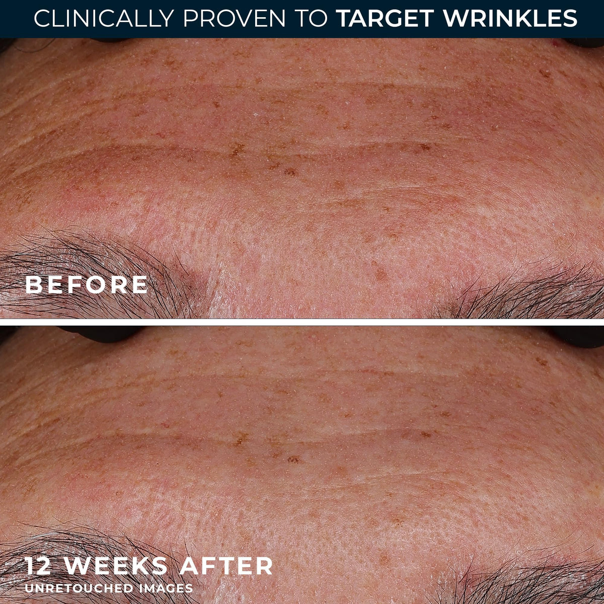 RoC serum staged in bathroom to show integration into daily routine