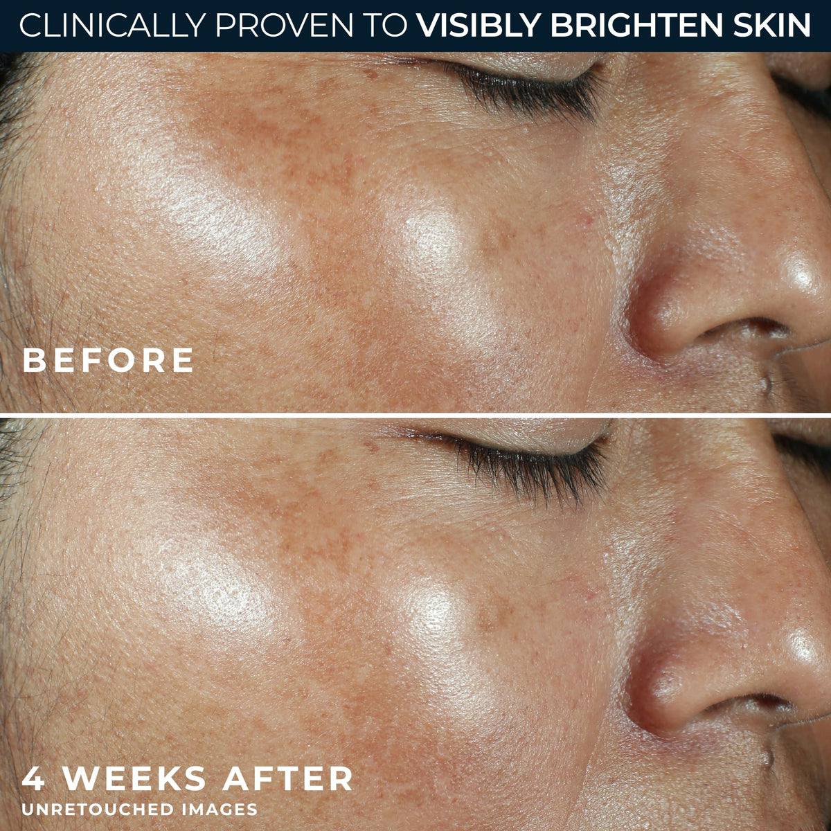 RoC Retinol Eye Cream packette pictured with moisturizer for routine boost