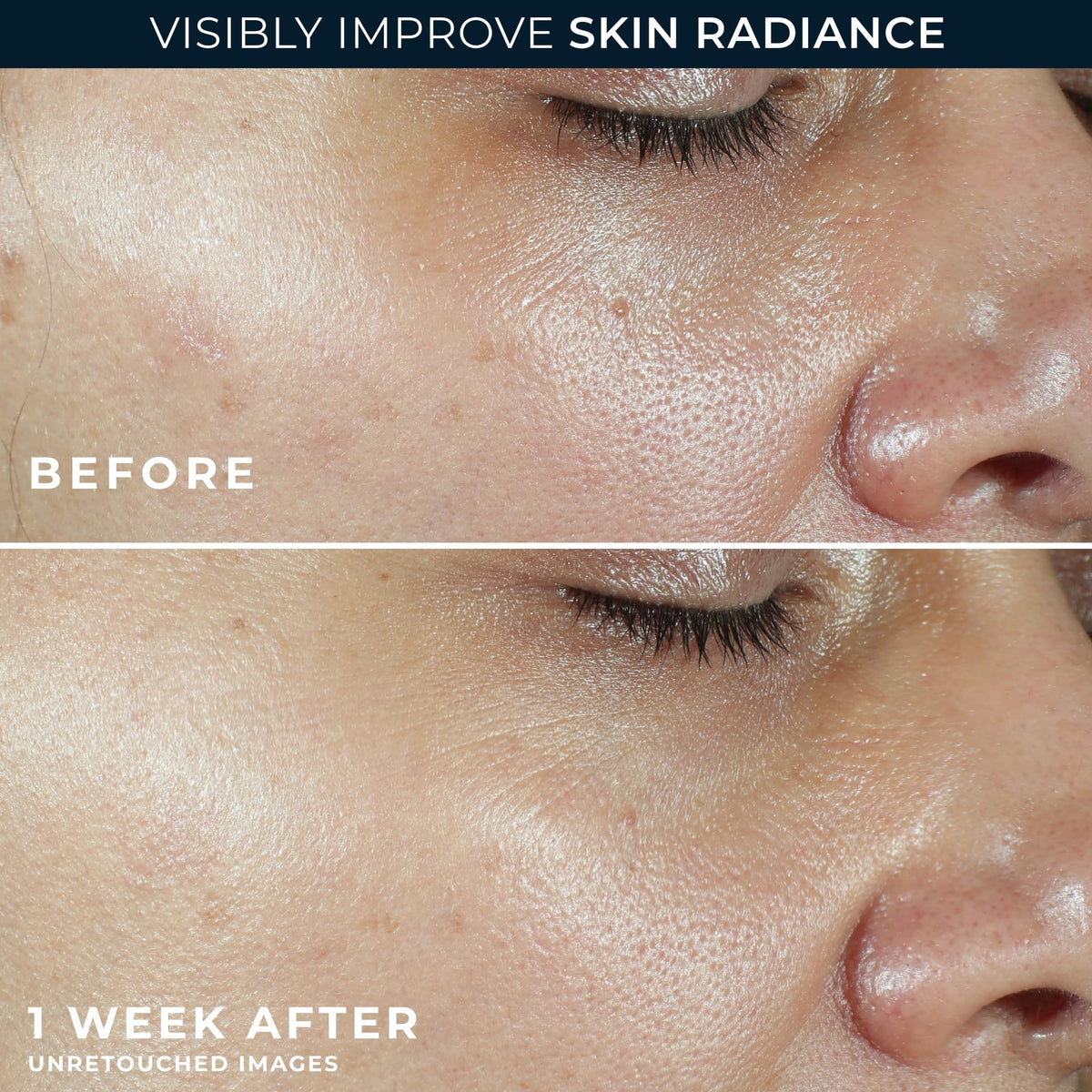 RoC label close-up highlighting ingredients, Vitamin C, peptides